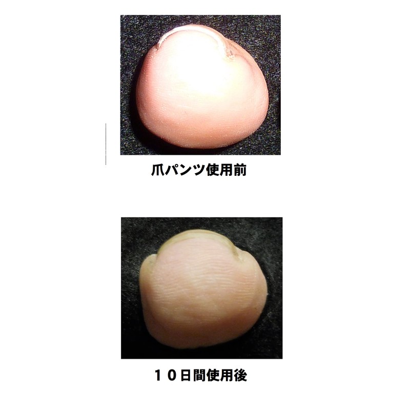 Nail Pants: For nails that are easy to wrap