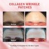 YIMEIR 16Pcs Forehead Wrinkle Patches, Hydrolyzed Collagen Overnight Facial Wrinkle
