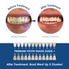 Whiter Image Professional Dental-Grade Teeth Whitening Gel, Sensitivity-Proof, 9% Hydrogen