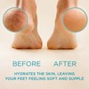 Lee Beauty 8oz Professional Gel Callus Remover for Feet -