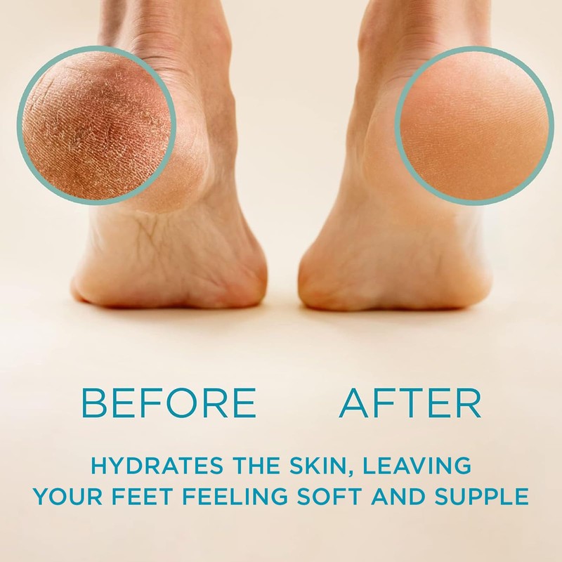 Lee Beauty 8oz Professional Gel Callus Remover for Feet -