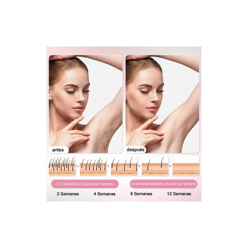 Ipl Depiladora De Luz Pulsada Laser Permanente Sin Dolor