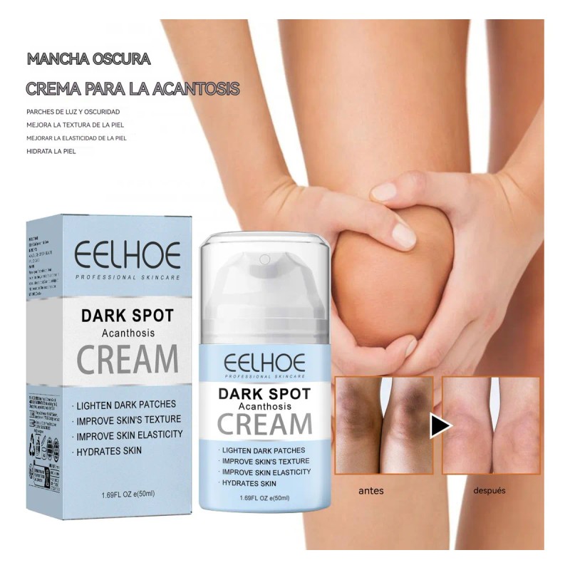 Ch Crema For Acantosis Y Melasma 50ml 1pcs .1