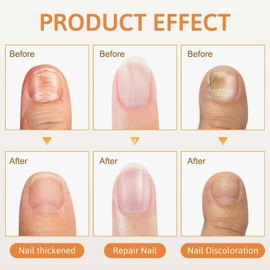 Aceite fortalecedor de uñas y reparador de cutículas, sérum fortalecedor para el crecimiento de uñas, sérum para uñas y aceite para el cuidado de cutículas, suaviza y nutre las cutículas (4PCS)