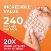 PatchRx Pimple Patches for Face (240 Patches), Hydrocolloid Pimple Patches,