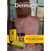 Kit Especial Para Psoriasis: Pomada, Jabón Y Crema.