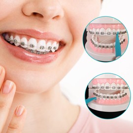 500 Pcs Orthodontic Elastic Bands, 3/16 Inch Braces Bands with 5 Pcs Placers Braces Teeth Accessory Rubberbands Fix Tooth Gap Latex Rubber Bands Rubberbands Dreadlocks Hair Braids