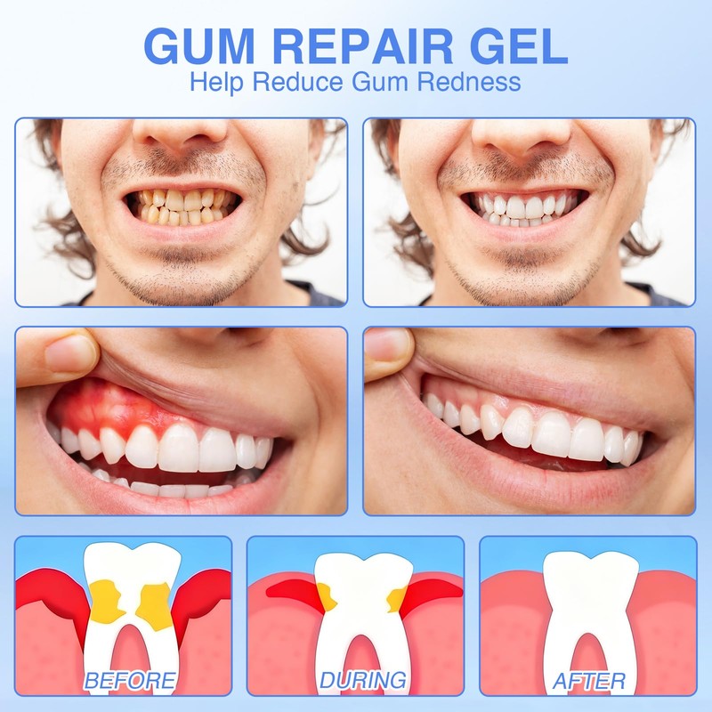 SarMee 4pcs Mullein Gum Repair Gel, Teeth Whitening Pen for