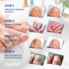 Tratamiento De Hongos En Las Uñas De Los Pies Vigorwell