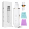 Limpiador Ultrasónico Portatil Skin Scrubber Limpieza Facial