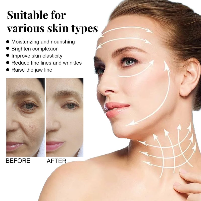 Protein Line Thread Lifting Set, Absorbable Collagen Thread, Active Collagen