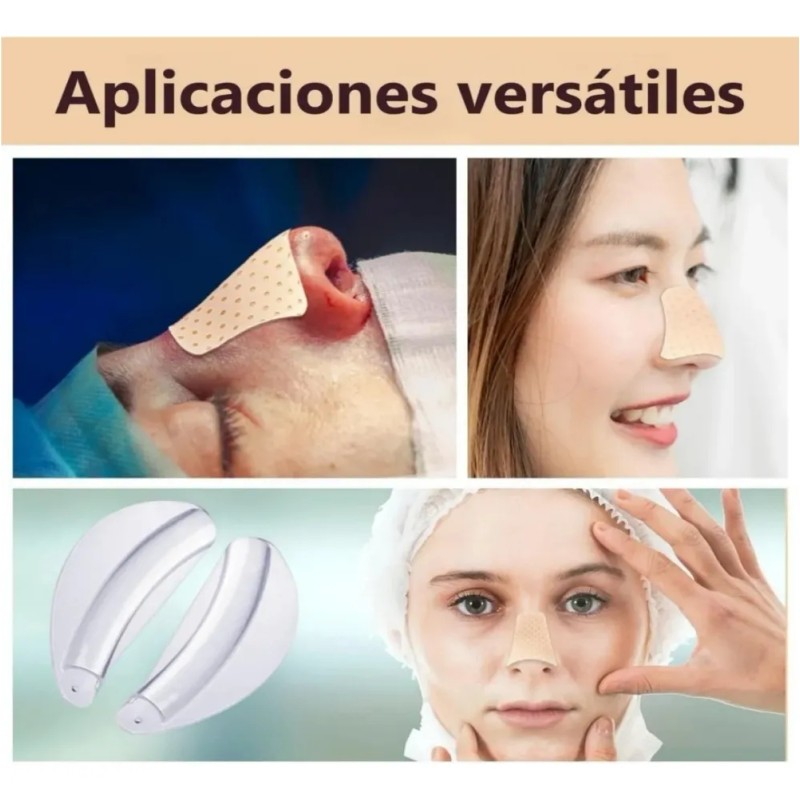 Kit Férula Doyle Nasales Médica Termoplásticas Rinoplastia Transparente