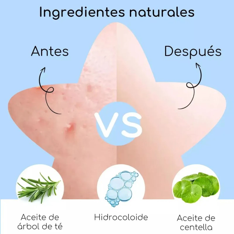 Miniso Tiras Nasales Para Mujer Puntos Negros Rosa 10 Piezas