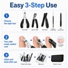 5-Piece Ingrown Toenail Tool Kit for Home Nail Care –