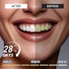 Woadee Nano Hydroxyapatite Toothpaste for Advanced Enamel Protection, Fluoride Free