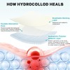 Hydrocolloid Roll for Wound Care - Medical Grade Hydrocolloid Bandages