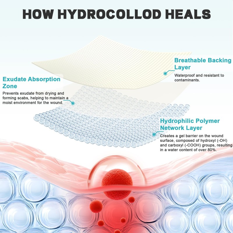 Hydrocolloid Roll for Wound Care - Medical Grade Hydrocolloid Bandages