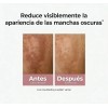 Eucerin Anti-pigment Dual Sérum Facial Anti-manchas 30ml Todo Tipo De