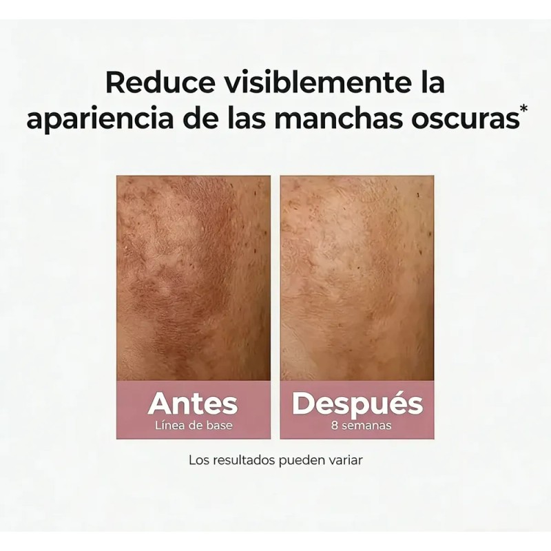 Eucerin Anti-pigment Dual Sérum Facial Anti-manchas 30ml Todo Tipo De