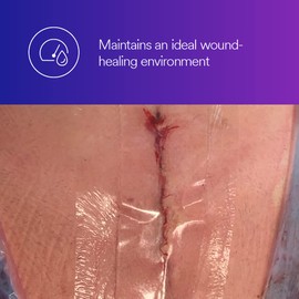 3M™ Tegaderm™ Absorbent Clear Acrylic Dressing, 90800, Oval, 3 in x 3-3/4 in (7.6 cm x 9.5 cm), 10/CAR, 4 CAR/CS