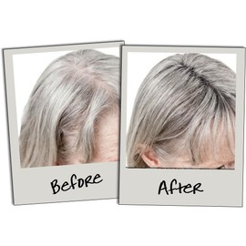 3D Hair Building Fibres for Thinning Hair, 35g Bottle Hair Fibres for Thinning Hair for Women & Men, Hair Powder for Thinning Hair - Make Hair Look Thicker in Seconds with hair filler (Dark Grey)