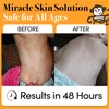 Monkey Balm All Natural Skin Care for Kids, Babies, Adults