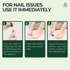 Ginger Tea Tree Oil 2Natural Herbs Nail Fungus Care Formula