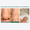 ANUA Limpiador Aceite Pore Control Mini Hipoalergnico Libre Parabenos 20ml