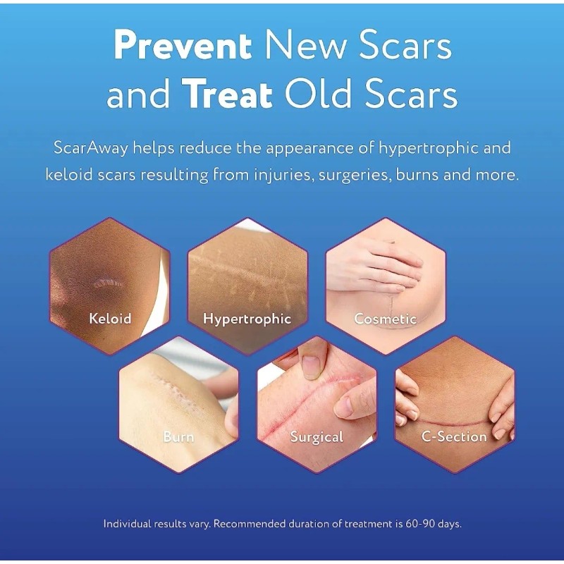 Scaraway Gel Roller Ball Para Cicatrices Queloides