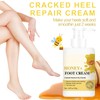 Honey Foot Cream for Cracked Heels & Dry Skin –Honey