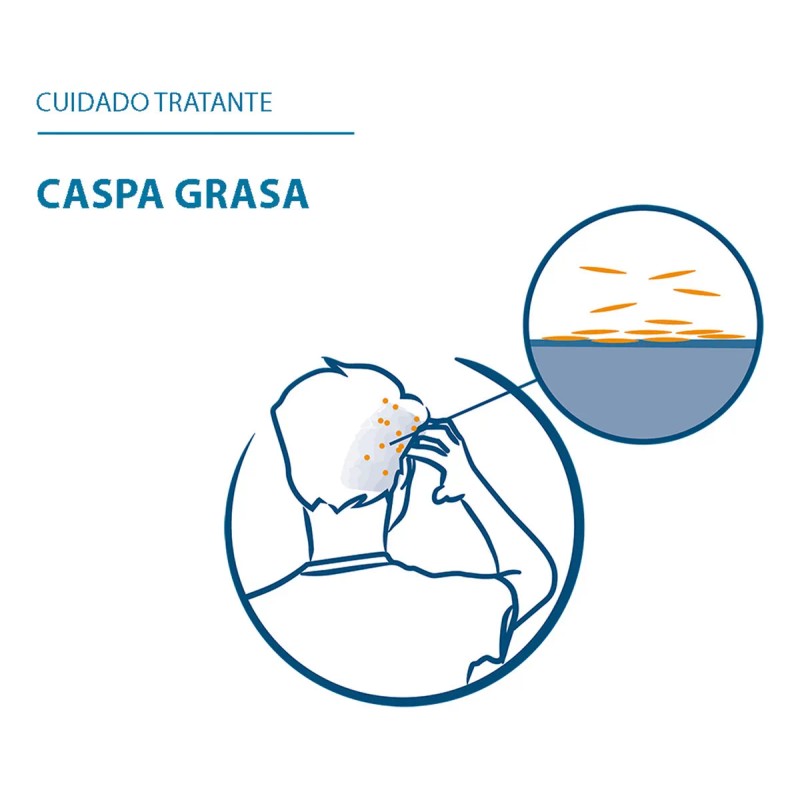 Ducray Shampoo Squarnorm Caspa Seca 200ml