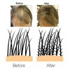 VolumON Professional Keratin Hair Building Fibres Hair Loss Concealer – 12g – Dark Brown