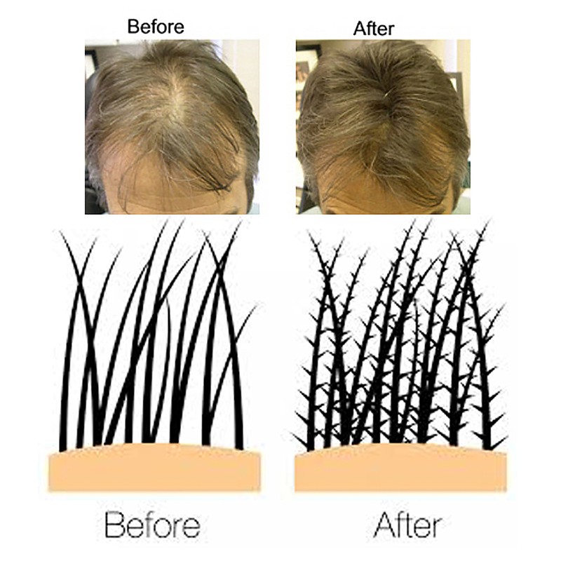 VolumON Professional Keratin Hair Building Fibres Hair Loss Concealer – 12g – Dark Brown