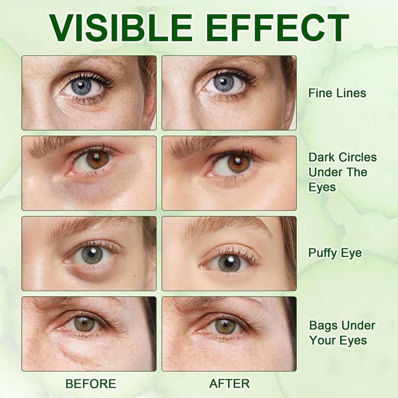 60 Parches Ojos Bolsas y Ojeras, Eye Patches Hidratante