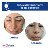 Kit Crema Día Despigmentante Piel Grasa +gel De Noche +jabón