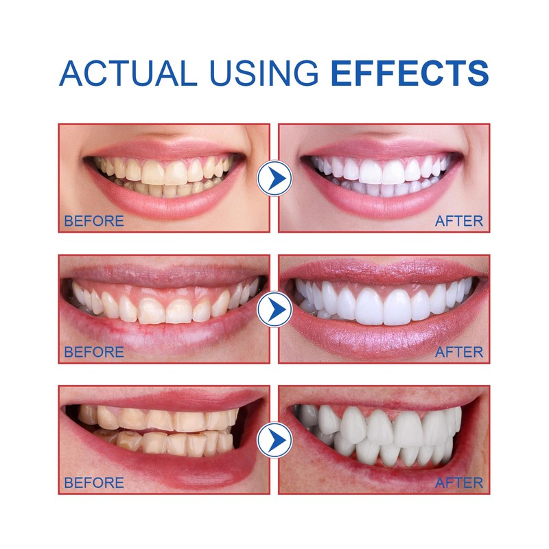 Sp-6 Toothpaste, 120 G Probiotics Bright White Toothpaste Toothpaste Sp-6