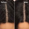 MIZANI Scalp Care Pyrithione Zinc Antidandruff Shampoo, 16.9 fl. oz.