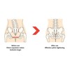 Sacroiliac SI Joint Hip Belt Breathable Lower Back Hip Support