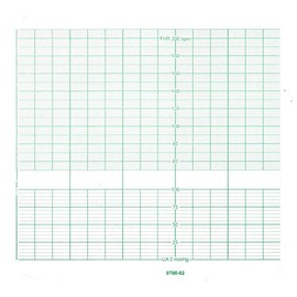 BIONET CARDIOCARE ECG Paper 152MM X 25M (5)