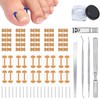Ingrown Toenail Corrector Set with Correction Strips, Professional ingrown toenails