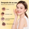 Kit Roll Anti Ojeras Bolsas Mirada Fresca Mopoyat