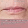 StriVectin, Double Fix™ for Lips Plumping & Vertical Line Treatment
