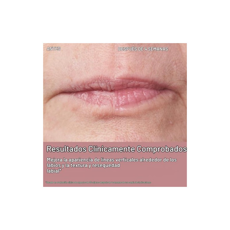 StriVectin, Double Fix™ for Lips Plumping & Vertical Line Treatment