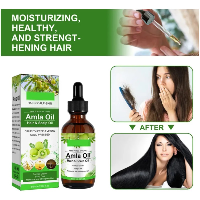 Mzl Aceite Capilar Amla Oil For Crecimiento Cabello