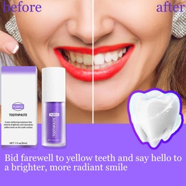 Purple Toothpaste, Whitening of Teeth, Purple Toothpaste, Professional Purple Toothpaste, Purple Toothpaste, Purple Toothpaste for Teeth Whitening