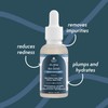 Nature Spell 2% BHA Liquid Exfoliant, Minimises Pores & Prevents