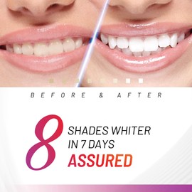 White Glo Accelerator Teeth Whitening Kit with LED Light for Sensitive Teeth and Gums, 3 Months of Professional Treatment, Carbamide Peroxide, Papaya, Pineapple Enzyme for Best Teeth Whitening Results