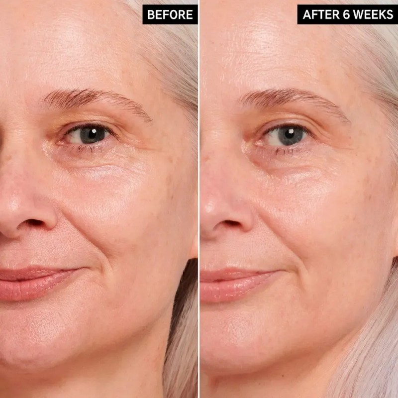 Crema Contorno Ojos The Inkey List Retinol Para Arrugas Piel