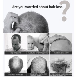 DISAAR BEAUTY Anti-Hair Loss Spray Tonic Deep Moisturize Nourish Repair Strengthen Hair Root Anti-Frizz Care 30ml / 1.01fl.oz