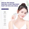 QUARXERY 3 in 1 Precisely Anti Acne Acne Spot Saviour